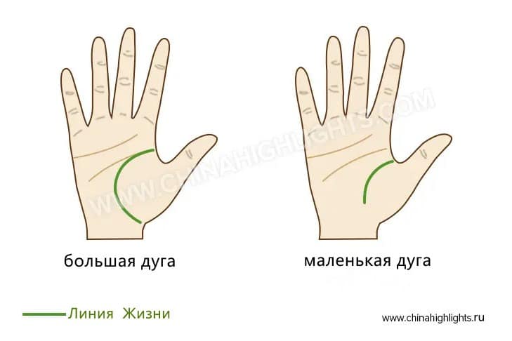 линия жизни