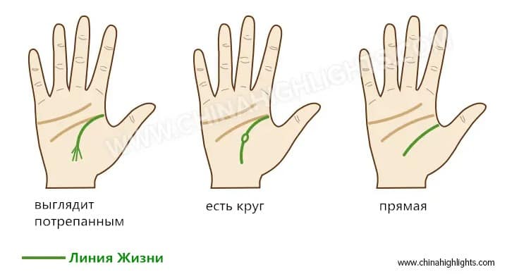 линия жизни