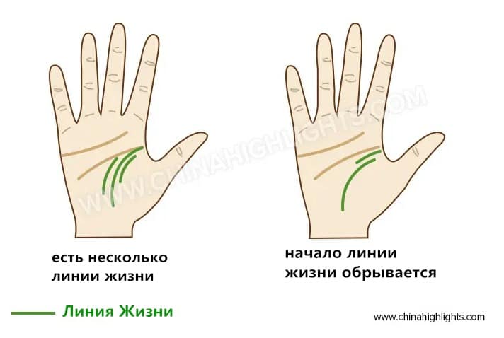линия жизни